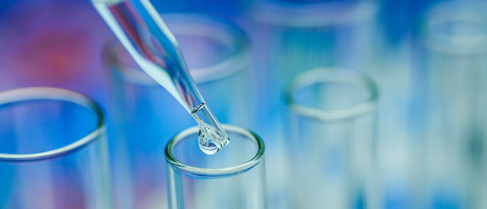 stock-photo-laboratory-test-tubes-206124868